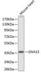 G Protein Subunit Alpha 15 antibody, 18-484, ProSci, Western Blot image 