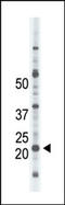 NME/NM23 Nucleoside Diphosphate Kinase 4 antibody, AP15153PU-N, Origene, Western Blot image 