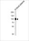 Plasminogen antibody, 62-814, ProSci, Western Blot image 