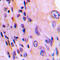 Rhotekin antibody, LS-C358298, Lifespan Biosciences, Immunohistochemistry paraffin image 