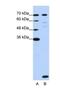 LSM2 Homolog, U6 Small Nuclear RNA And MRNA Degradation Associated antibody, NBP1-57504, Novus Biologicals, Western Blot image 