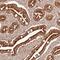 Zinc Finger Protein 776 antibody, NBP1-92644, Novus Biologicals, Immunohistochemistry paraffin image 