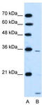 Solute Carrier Family 25 Member 39 antibody, TA333786, Origene, Western Blot image 