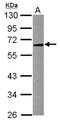 Sphingomyelin Phosphodiesterase 1 antibody, NBP2-20426, Novus Biologicals, Western Blot image 