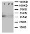 Translocation Associated Membrane Protein 2 antibody, LS-C313141, Lifespan Biosciences, Western Blot image 