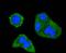 Inositol Polyphosphate-5-Phosphatase D antibody, A03358Y1020, Boster Biological Technology, Immunocytochemistry image 