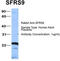 Serine And Arginine Rich Splicing Factor 9 antibody, TA345856, Origene, Western Blot image 