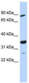 PDLIM1 Interacting Kinase 1 Like antibody, TA337868, Origene, Western Blot image 