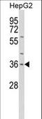 Interleukin 1 Alpha antibody, LS-C165183, Lifespan Biosciences, Western Blot image 