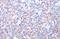Major Histocompatibility Complex, Class I, A antibody, GTX114080, GeneTex, Immunohistochemistry paraffin image 
