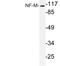 Neurofilament Medium antibody, LS-C199941, Lifespan Biosciences, Western Blot image 