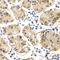 Chitinase 1 antibody, A03406, Boster Biological Technology, Immunohistochemistry paraffin image 