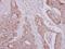 Asparaginyl-TRNA Synthetase 2, Mitochondrial antibody, LS-C155529, Lifespan Biosciences, Immunohistochemistry frozen image 