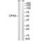 Carboxypeptidase A5 antibody, A13307, Boster Biological Technology, Western Blot image 