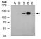 Dengue Virus Type II antibody, PA5-32200, Invitrogen Antibodies, Western Blot image 