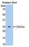 Matrix Metallopeptidase 13 antibody, LS-C298276, Lifespan Biosciences, Western Blot image 