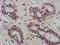 ADP Ribosylation Factor Related Protein 1 antibody, LS-C669735, Lifespan Biosciences, Immunohistochemistry paraffin image 