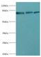 Enhancer Of Zeste 1 Polycomb Repressive Complex 2 Subunit antibody, MBS1494150, MyBioSource, Western Blot image 