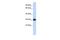 Sushi Domain Containing 3 antibody, PA5-44351, Invitrogen Antibodies, Western Blot image 