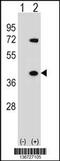 Heterogeneous Nuclear Ribonucleoprotein A1 antibody, 58-858, ProSci, Western Blot image 