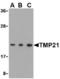 Transmembrane P24 Trafficking Protein 10 antibody, TA306375, Origene, Western Blot image 