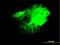 CDC42 Binding Protein Kinase Beta antibody, H00009578-M03, Novus Biologicals, Immunofluorescence image 