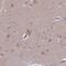 Clavesin 2 antibody, NBP2-47504, Novus Biologicals, Immunohistochemistry paraffin image 