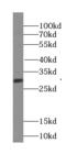 Surfeit 2 antibody, FNab08400, FineTest, Western Blot image 