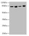 DExD-Box Helicase 50 antibody, CSB-PA861080LA01HU, Cusabio, Western Blot image 