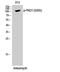 Serine/threonine-protein kinase D1 antibody, STJ90880, St John