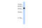 UDP-Glucose Pyrophosphorylase 2 antibody, 30-393, ProSci, Enzyme Linked Immunosorbent Assay image 