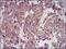 Insulin Like Growth Factor 2 antibody, NBP2-37462, Novus Biologicals, Immunohistochemistry frozen image 