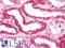 AFG3 Like Matrix AAA Peptidase Subunit 2 antibody, LS-C210891, Lifespan Biosciences, Immunohistochemistry paraffin image 