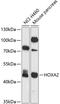 Homeobox A2 antibody, 23-891, ProSci, Western Blot image 