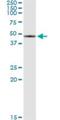 Serpin Family B Member 2 antibody, H00005055-M08, Novus Biologicals, Immunoprecipitation image 