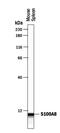 S100 Calcium Binding Protein A8 antibody, PA5-47439, Invitrogen Antibodies, Western Blot image 