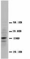 Calbindin 2 antibody, LS-C171674, Lifespan Biosciences, Western Blot image 