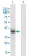 Beta-1,3-Galactosyltransferase 6 antibody, H00126792-M06, Novus Biologicals, Western Blot image 