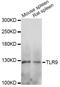 Toll Like Receptor 9 antibody, LS-C749639, Lifespan Biosciences, Western Blot image 
