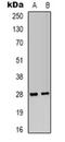 Insulin Like Growth Factor Binding Protein 1 antibody, orb319063, Biorbyt, Western Blot image 