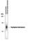 TPH1 antibody, PPS038, R&D Systems, Western Blot image 