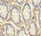 Rhomboid Like 2 antibody, orb240752, Biorbyt, Immunohistochemistry paraffin image 