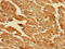 Lactate Dehydrogenase D antibody, LS-C398927, Lifespan Biosciences, Immunohistochemistry paraffin image 