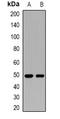 DIRAS Family GTPase 3 antibody, orb378032, Biorbyt, Western Blot image 