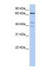 Intracisternal A Particle-Promoted Polypeptide antibody, NBP1-56903, Novus Biologicals, Western Blot image 