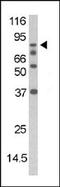 Death Domain Associated Protein antibody, AP12599PU-N, Origene, Western Blot image 