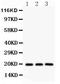 Serine And Arginine Rich Splicing Factor 3 antibody, PB9509, Boster Biological Technology, Western Blot image 