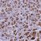 Bestrophin 2 antibody, HPA046229, Atlas Antibodies, Immunohistochemistry paraffin image 