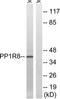 Nuclear inhibitor of protein phosphatase 1 antibody, TA314374, Origene, Western Blot image 