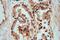 TPD52 Like 1 antibody, 14732-1-AP, Proteintech Group, Immunohistochemistry paraffin image 